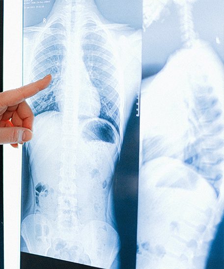 Checking Lung X-Ray — Health Specialists on Fraser Coast, QLD